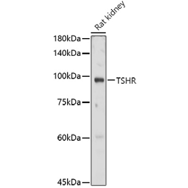TSHR Rabbit Polyclonal Antibody