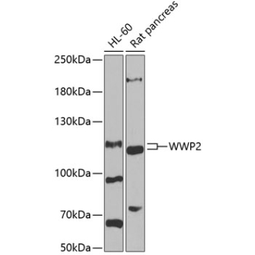 WWP2 Rabbit Polyclonal Antibody