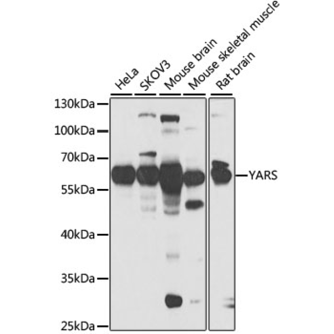YARS Rabbit Polyclonal Antibody
