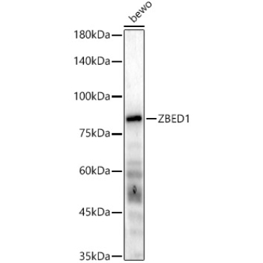ZBED1 Rabbit Polyclonal Antibody