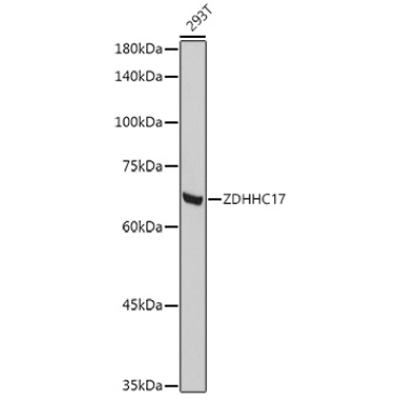 ZDHHC17 Rabbit Polyclonal Antibody