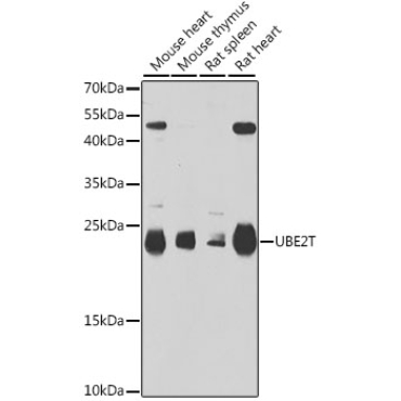 UBE2T Rabbit Polyclonal Antibody