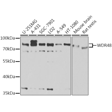 WDR48 Rabbit Polyclonal Antibody