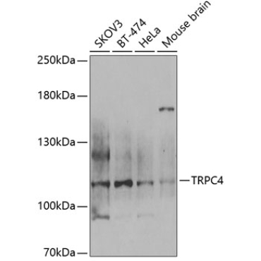TRPC4 Rabbit Polyclonal Antibody