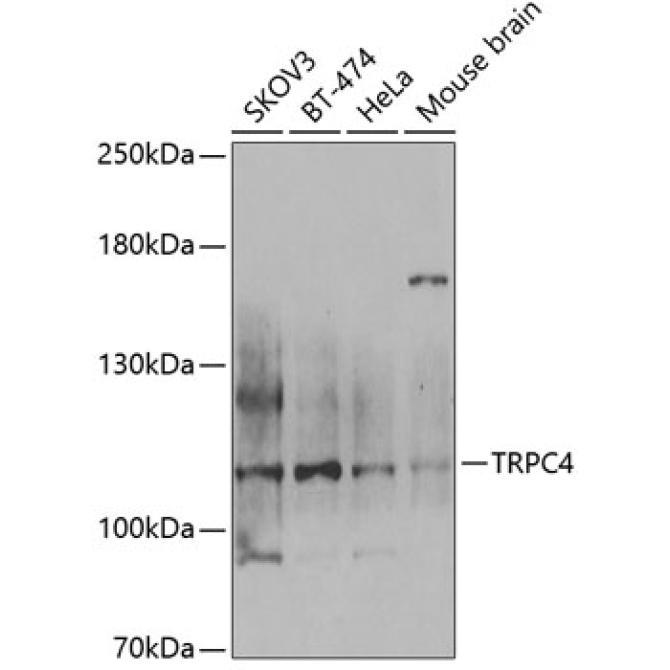TRPC4 Rabbit Polyclonal Antibody
