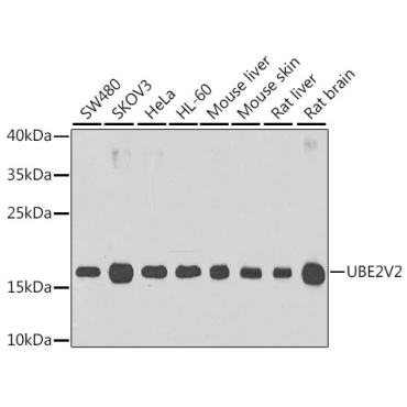 UBE2V2 Rabbit Polyclonal Antibody