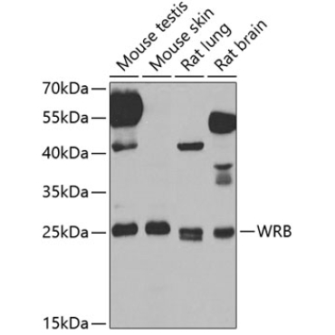 WRB Rabbit Polyclonal Antibody