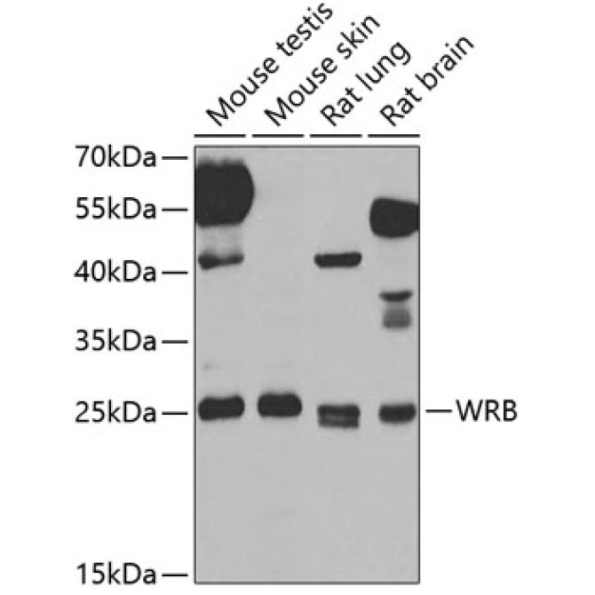 WRB Rabbit Polyclonal Antibody