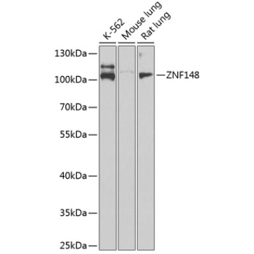 ZNF26,600 Rabbit Polyclonal Antibody