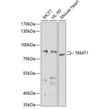 TRMT1 Rabbit Polyclonal Antibody