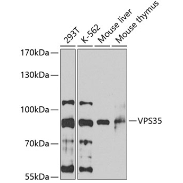 VPS35 Rabbit Polyclonal Antibody