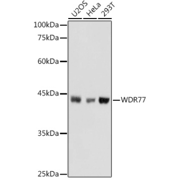 WDR77 Rabbit Polyclonal Antibody
