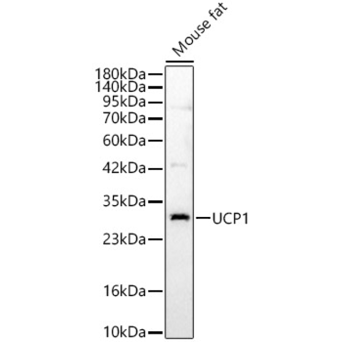 UCP1 Rabbit Polyclonal Antibody