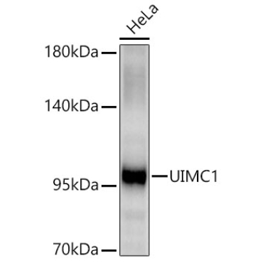UIMC1 Rabbit Polyclonal Antibody
