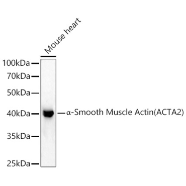 Alpha-Smooth Muscle Actin (ACTA2) Rabbit Polyclonal Antibody