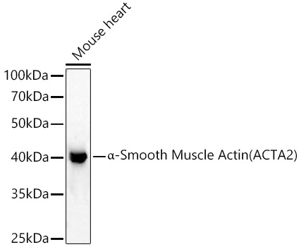 Alpha-Smooth Muscle Actin (ACTA2) Rabbit Polyclonal Antibody