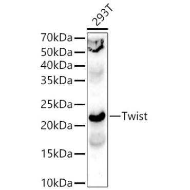 Twist Rabbit Polyclonal Antibody
