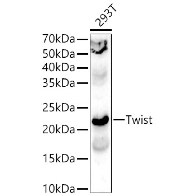 Twist Rabbit Polyclonal Antibody