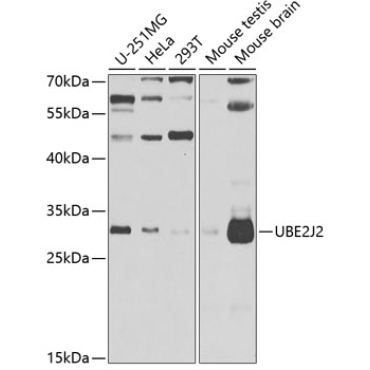UBE2J2 Rabbit Polyclonal Antibody