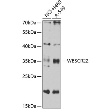 WBSCR22 Rabbit Polyclonal Antibody