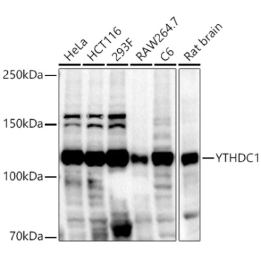 YTHDC1 Rabbit Polyclonal Antibody