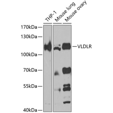 VLDLR Rabbit Polyclonal Antibody
