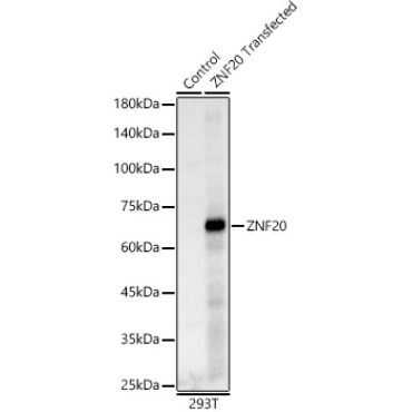 ZNF20 Rabbit Polyclonal Antibody