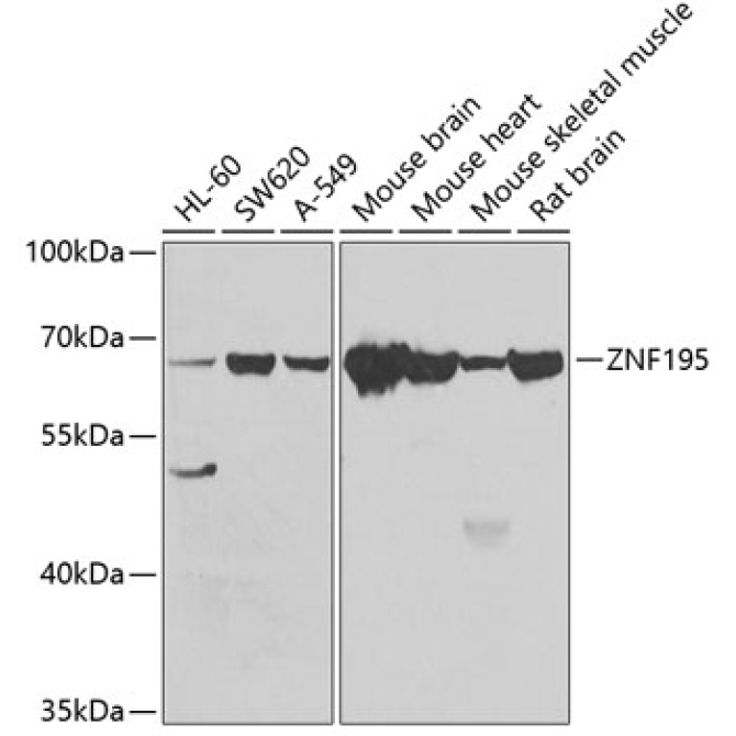 ZNF195 Rabbit Polyclonal Antibody