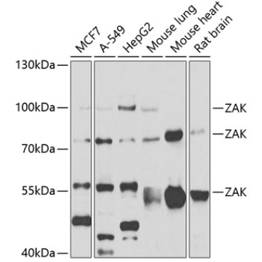 ZAK Rabbit Polyclonal Antibody