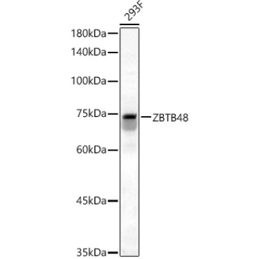 ZBTB48 Rabbit Polyclonal Antibody
