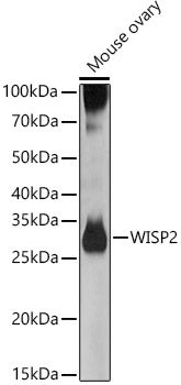 WISP2 Rabbit Polyclonal Antibody