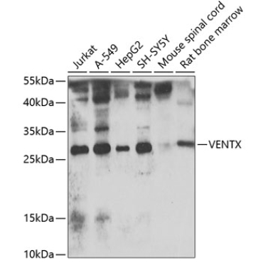 VENTX Rabbit Polyclonal Antibody