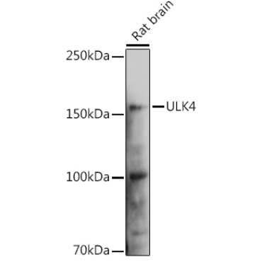 ULK4 Rabbit Polyclonal Antibody
