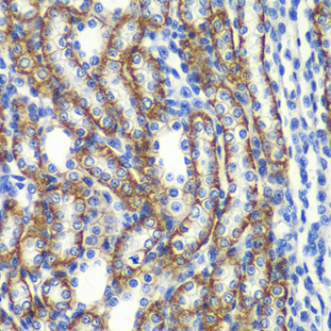 ZFAND3 Rabbit Polyclonal Antibody