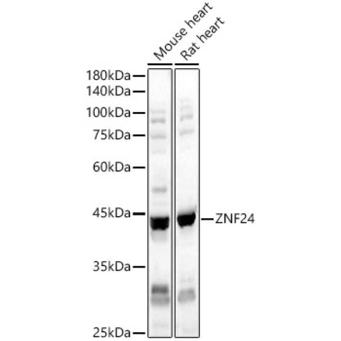 ZNF24 Rabbit Polyclonal Antibody