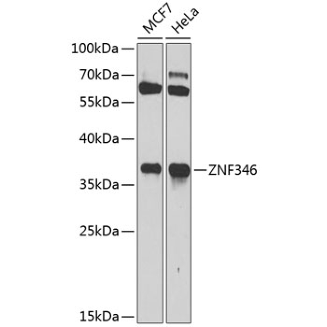ZNF346 Rabbit Polyclonal Antibody