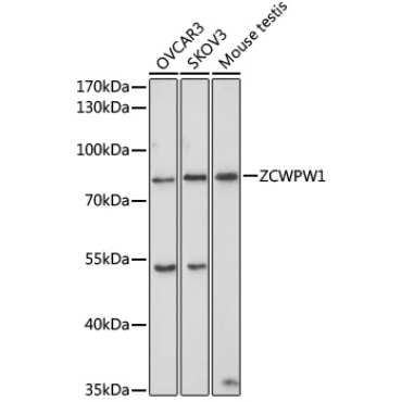 ZCWPW1 Rabbit Polyclonal Antibody