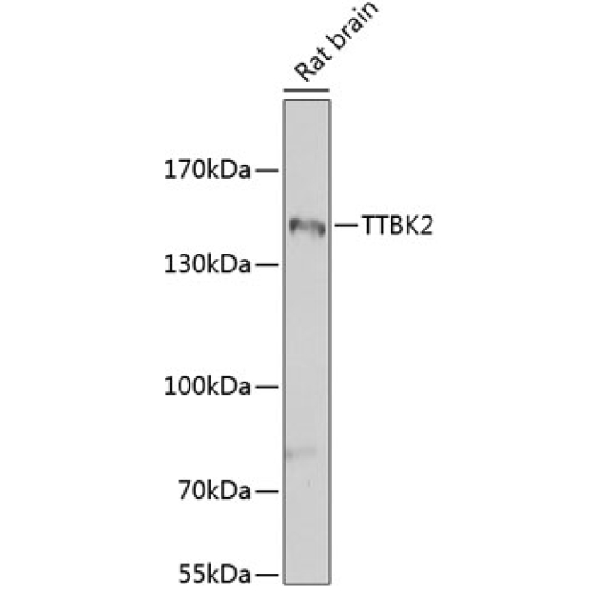 TTBK2 Rabbit Polyclonal Antibody