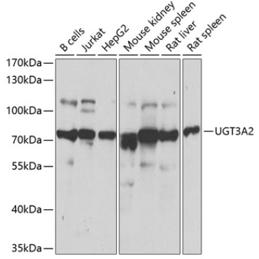 UGT3A2 Rabbit Polyclonal Antibody