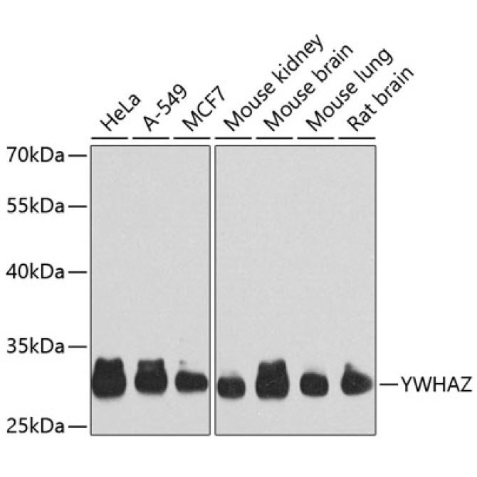 YWHAZ Rabbit Polyclonal Antibody