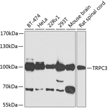 TRPC3 Rabbit Polyclonal Antibody
