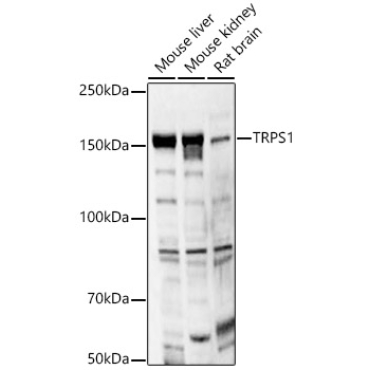 TRPS1 Rabbit Polyclonal Antibody