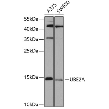 UBE2A Rabbit Polyclonal Antibody