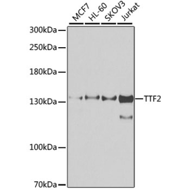 TTF2 Rabbit Polyclonal Antibody