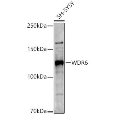 WDR6 Rabbit Polyclonal Antibody