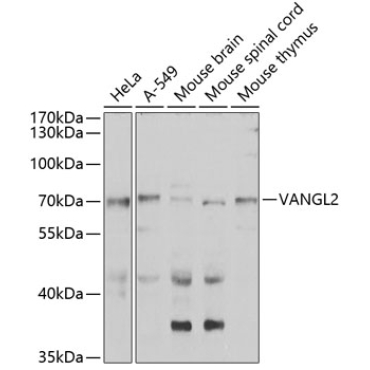VANGL2 Rabbit Polyclonal Antibody