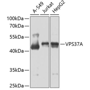 VPS37A Rabbit Polyclonal Antibody