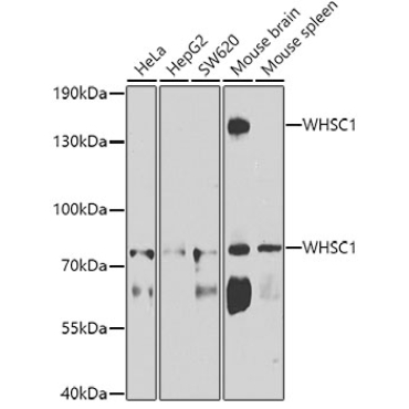 WHSC1 Rabbit Polyclonal Antibody