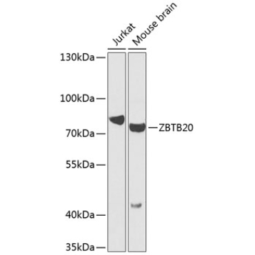 ZBTB20 Rabbit Polyclonal Antibody