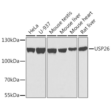 USP26 Rabbit Polyclonal Antibody
